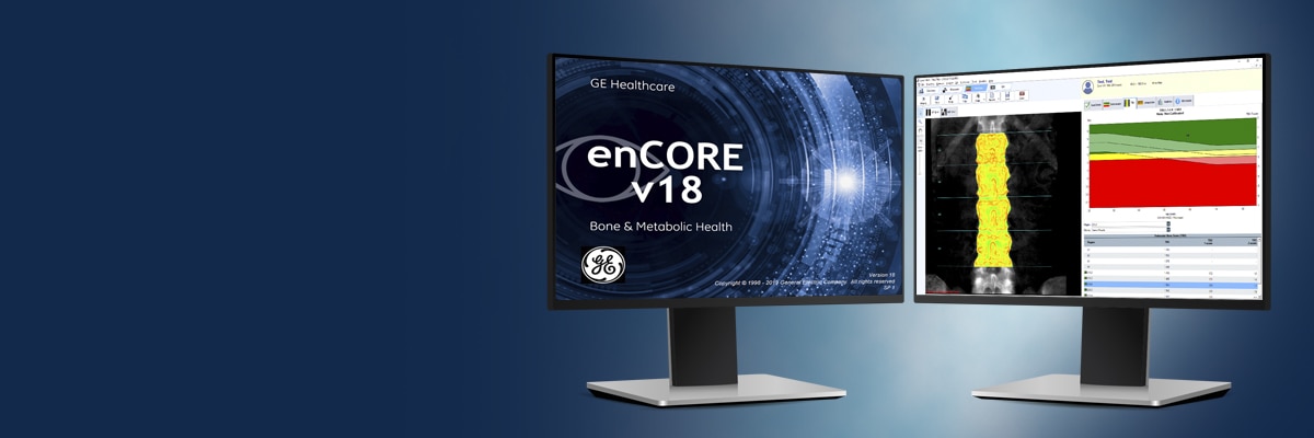 enCORE Software Platform | GE HealthCare (Japan)