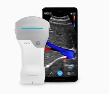Vscan Air Details | GE HealthCare (Japan) Vscan Air Details | GE HealthCare (Japan)