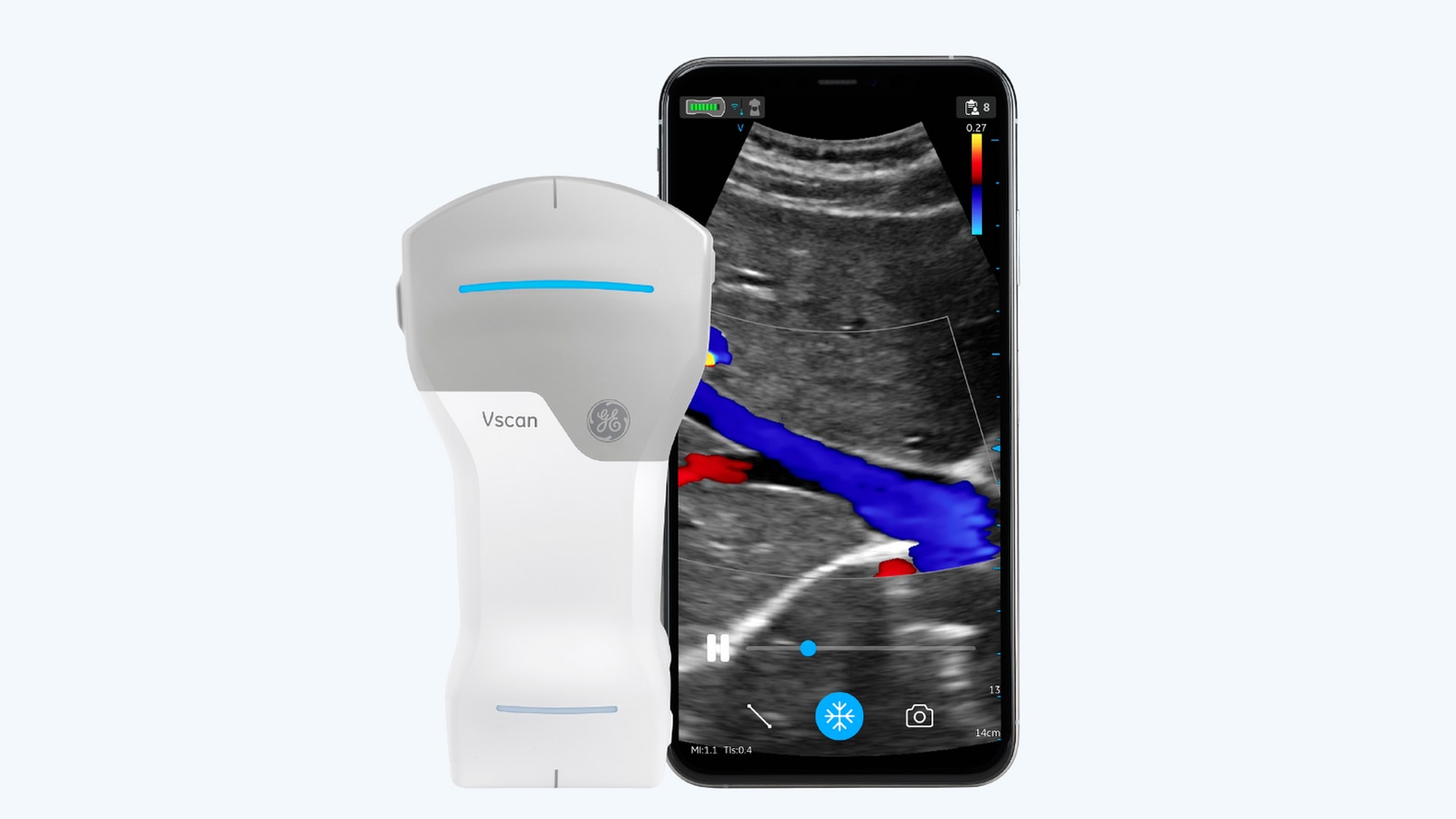 Handheld Ultrasound Vscan Family | GE Healthcare (Japan)