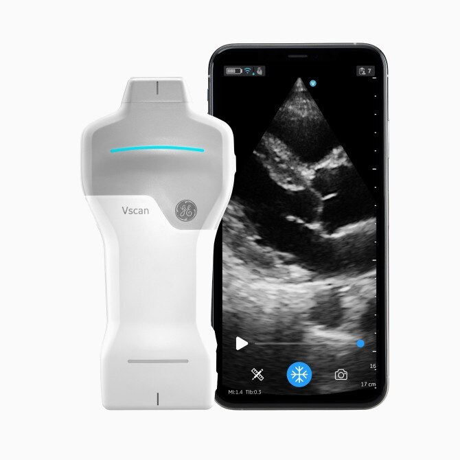 GE Healthcare Vscan ハンディスキャナー GE-Healthcare-V-Scan-Single-
