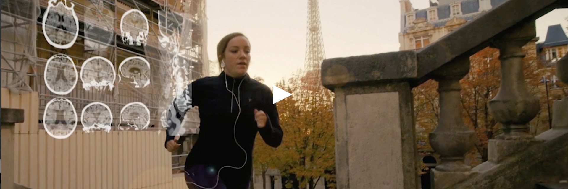 GEHCRevolutionAscendOverviewImage2-Video