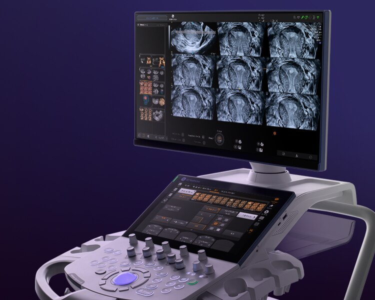 Voluson Signature 18 | GE HealthCare (Japan)