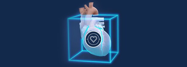 SnapShot Freeze 2 | GE HealthCare (Japan)
