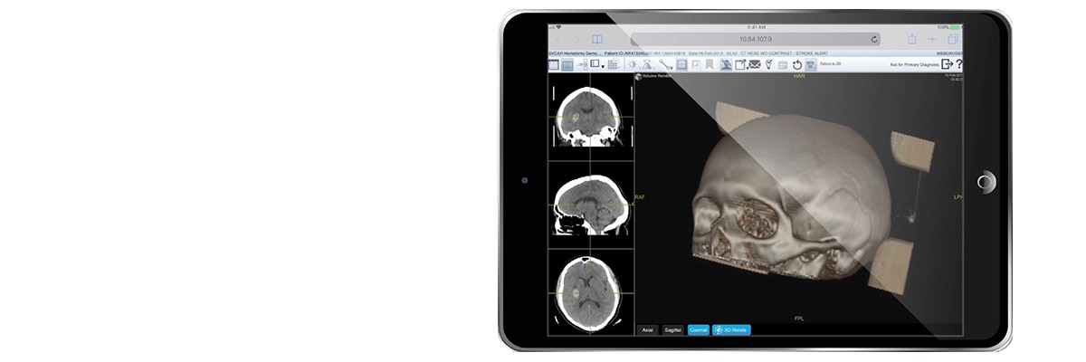 Centricity Universal Viewer Zero Footprint | GE HealthCare