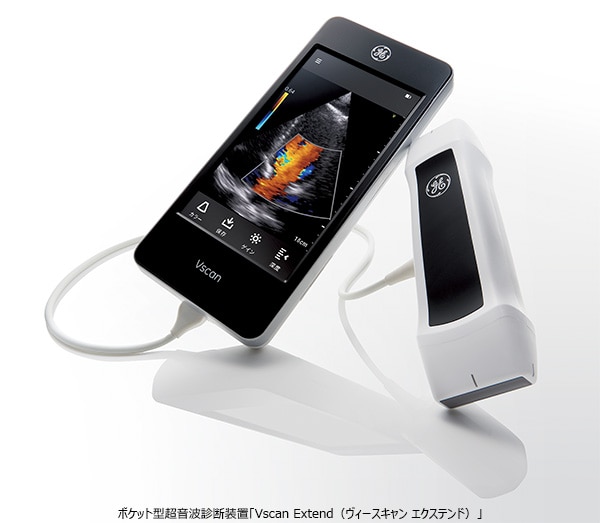 超音波検査装置（エコー） 超音波診断装置 | 山内メディカルクリニック