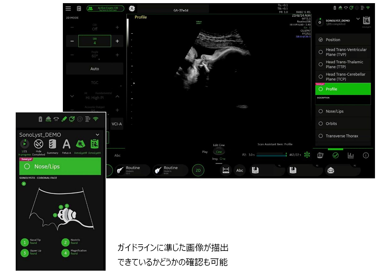 GEヘルスケア・ジャパン 産婦人科向け超音波画像診断装置「Voluson