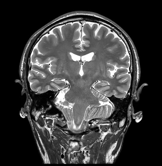 GEヘルスケア・ジャパン、新プラットホーム「AIR™ IQ Edition」を全MRI