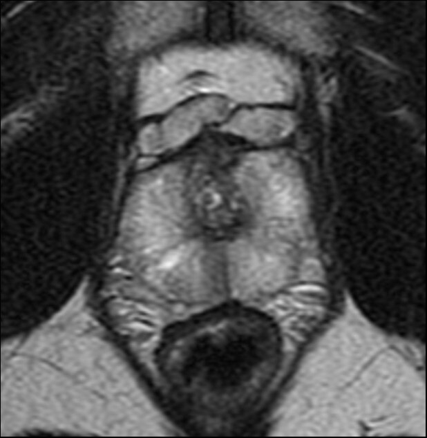 GEヘルスケア・ジャパン、新プラットホーム「AIR™ IQ Edition」を全MRI