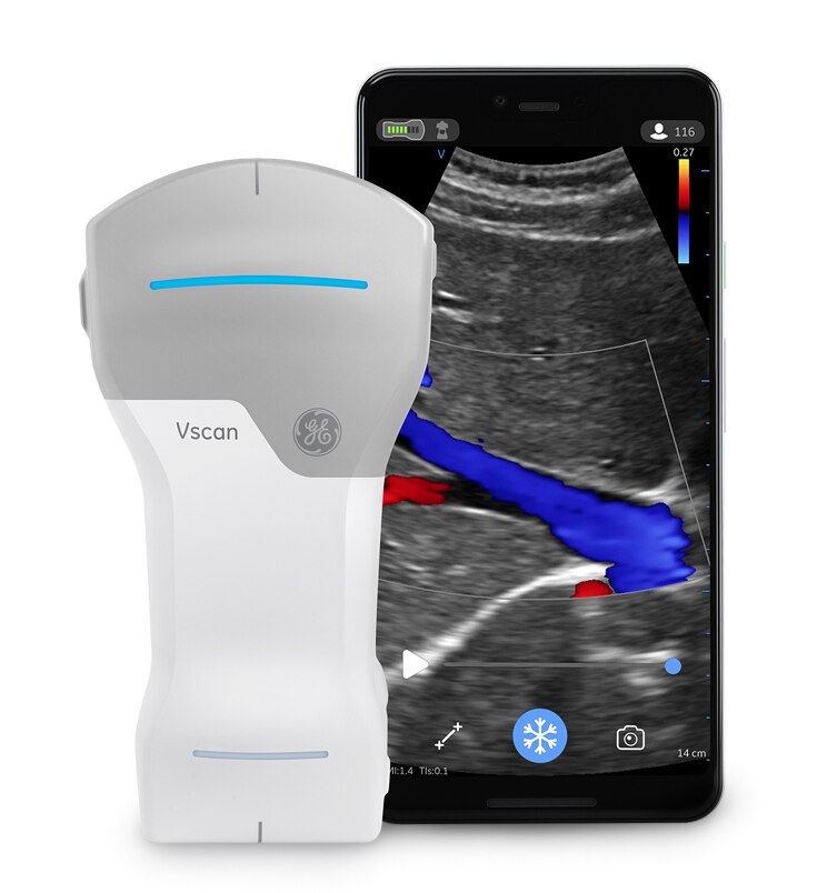 GEヘルスケア・ジャパン 「聴診器」のように持ち運べ、様々な医療