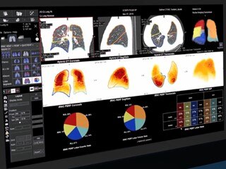 world社 テクノロジー製品 VYVO エクステンス 血糖レベル world社 テクノロジー製品 VYVO エクステンス 血糖レベルの通販
