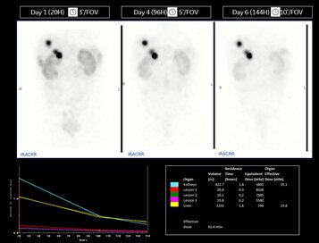 270keVまで対応の検出器でTheranosticsをサポート