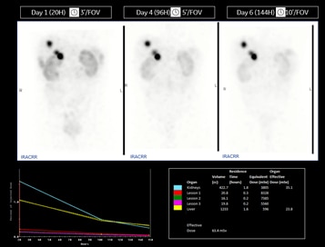 270keVまで対応の検出器でTheranosticsをサポート