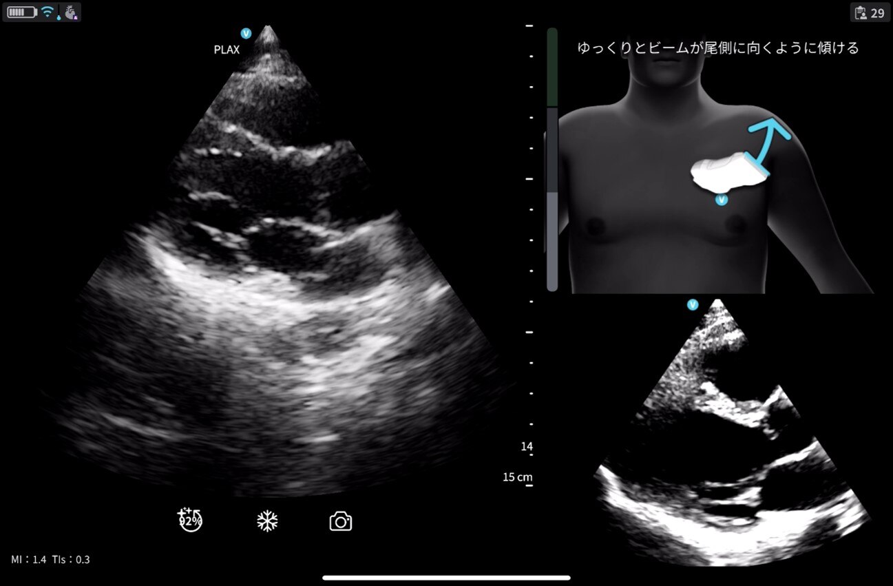 GEヘルスケア・ジャパン、超音波診断装置「Vscan」シリーズにAI機能を