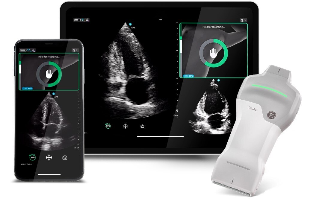 GE Healthcare Vscan ハンディスキャナー GE Healthcare Vscan ハンディスキャナー GE Healthcare VSCAN V