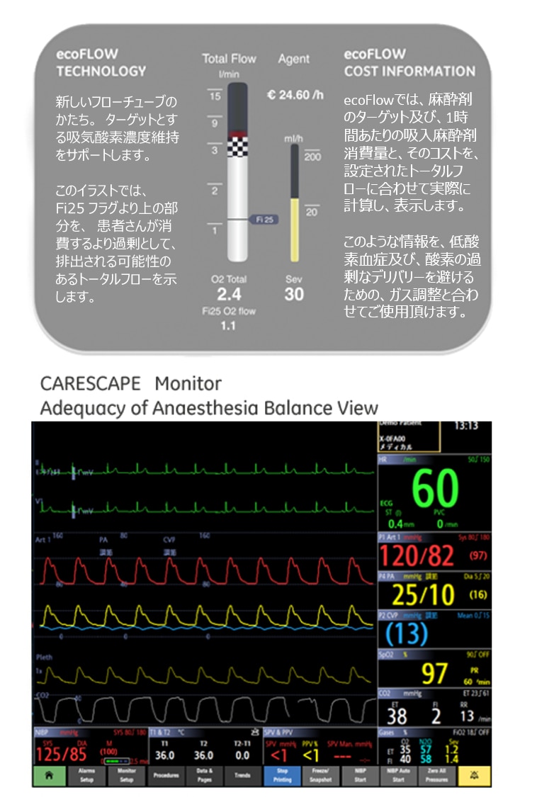 Avance CS2with ecoFLOW | GE HealthCare (Japan)