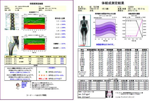 ロコモティブシンドロームとは？ ～超高齢社会に不可欠な対策を進め 