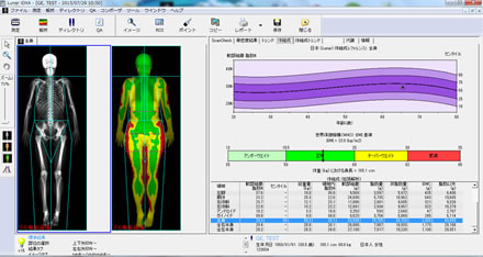 日常診療に役立つサルコペニアに関する基礎知識 | GE HealthCare (Japan)