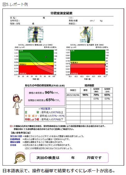 全身用骨密度測定装置（GE社製DXA骨密度測定装置 PRODIGY）の