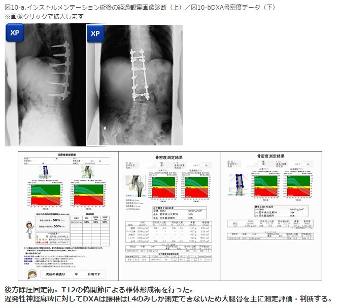 図解理学療法検査・測定ガイド 楽天市場】図解理学療法検査・測定ガイドの通販