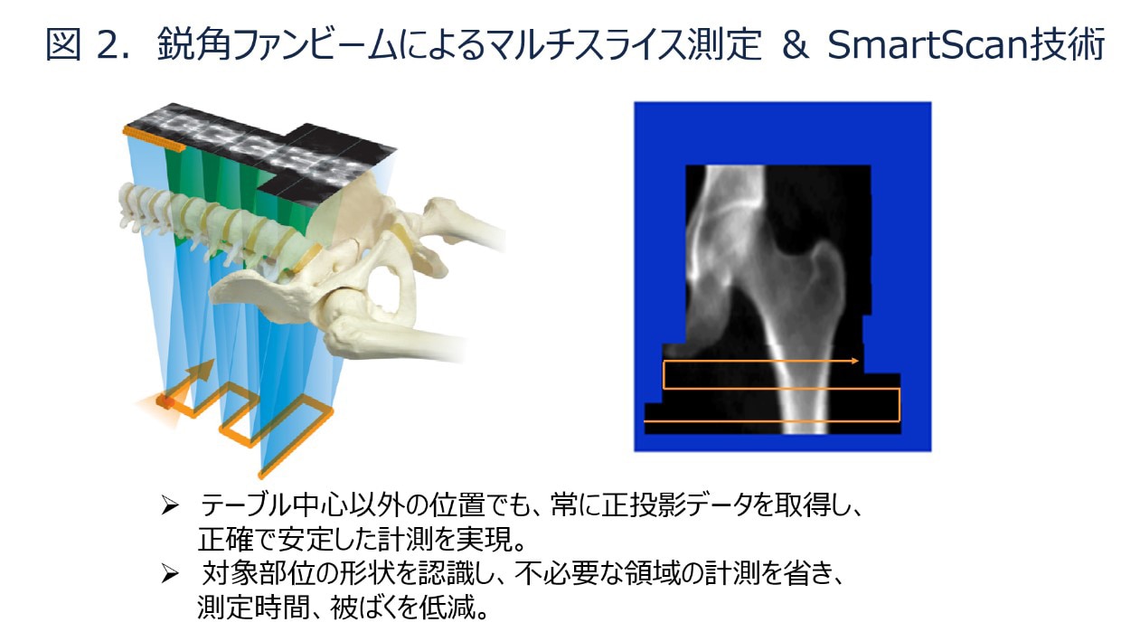 触診可動検査・ソフト徒手矯正法 腹腔鏡下触診システム | 【技術の宝庫】名工大 研究紹介・シーズ集