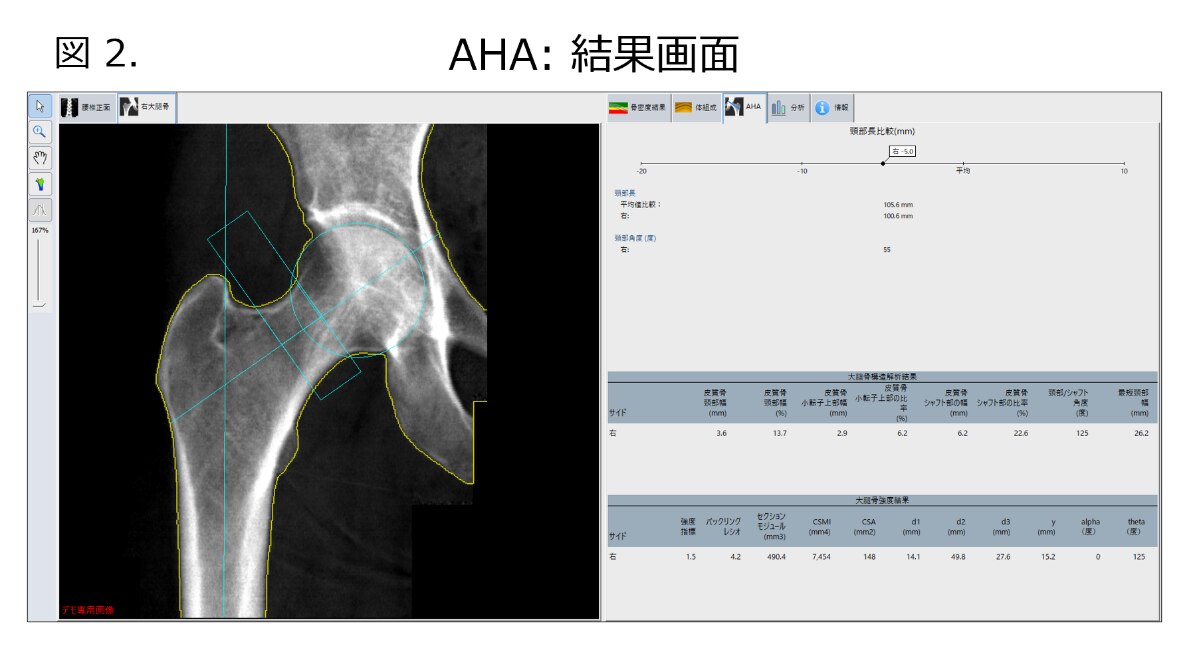 構造医学解析 I Amazon.co.jp: 構造医学解析 (1) : 吉田勧持: 本