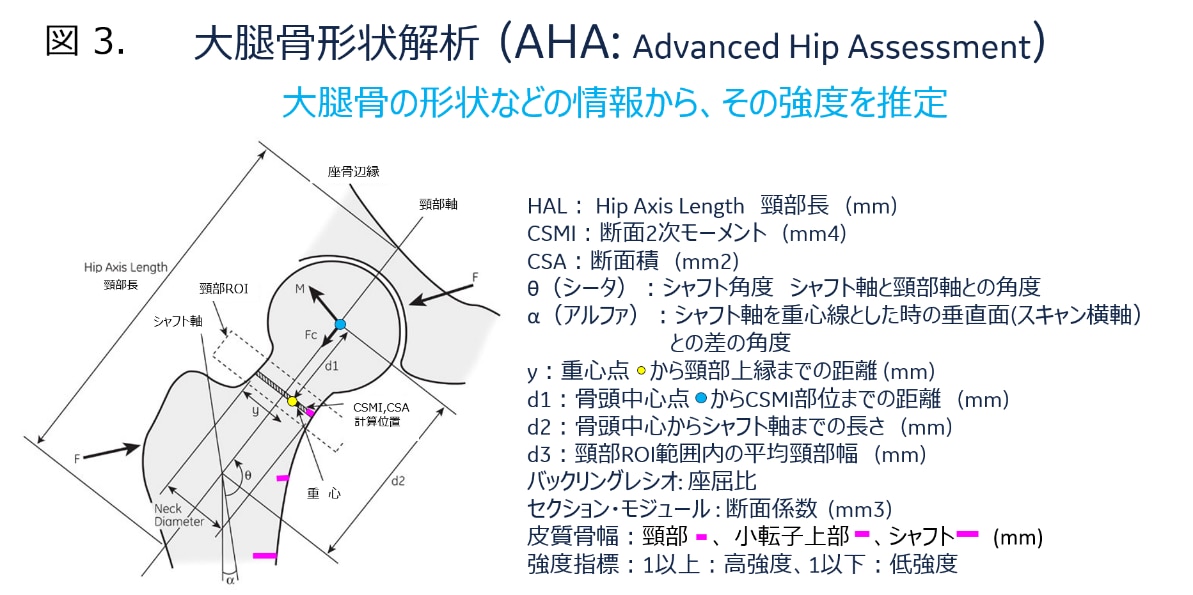 大腿骨構造解析ツール AHA: Advanced Hip Assessment｜骨密の