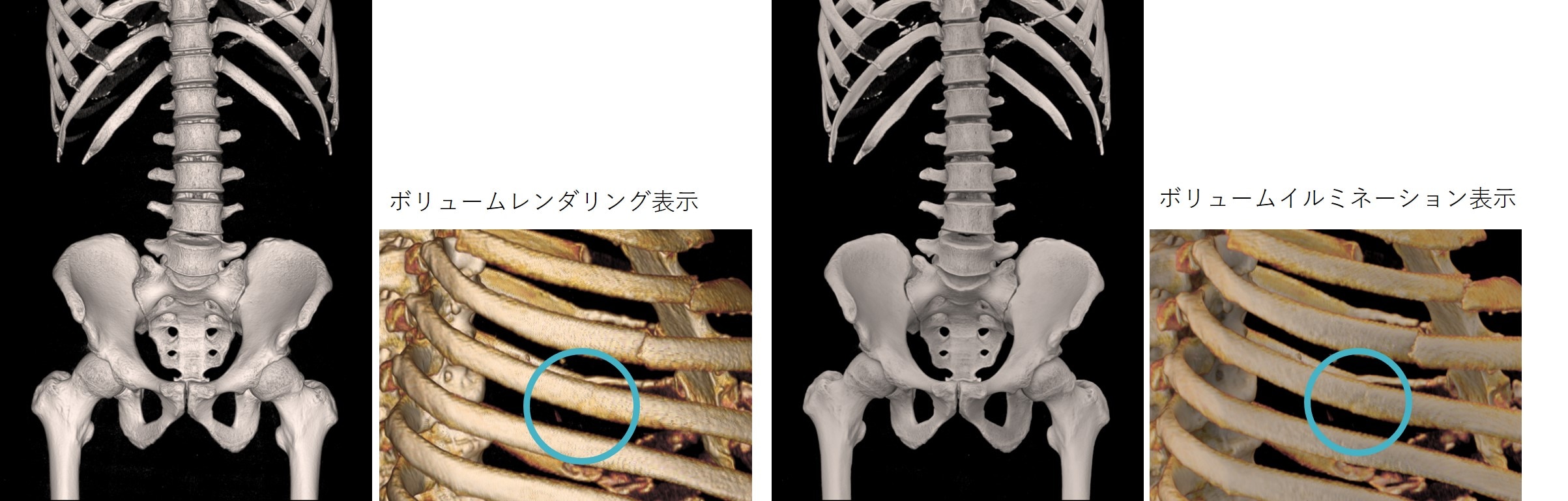 患難から栄光へ 上下 + 使徒行伝 1582、1583、1584年の日本（の状況についての）覚書、ならびに