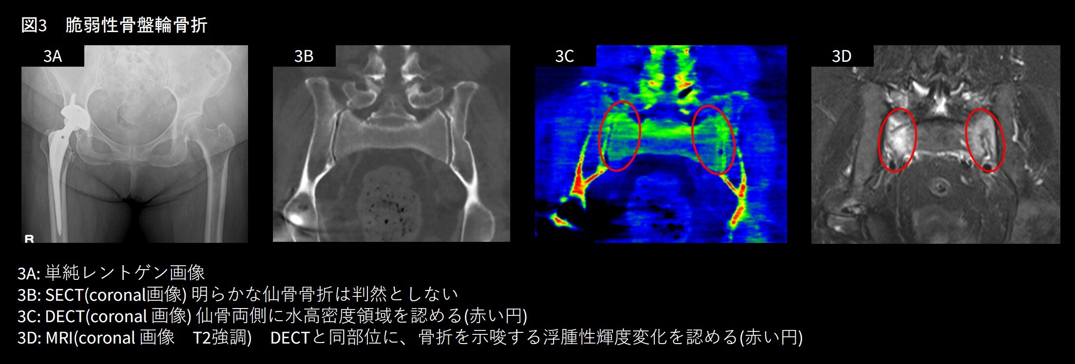 Dual-energy CT 原理を理解し臨床で活用する 51yVYXVguaL._AC_SY200_QL15_.jpg