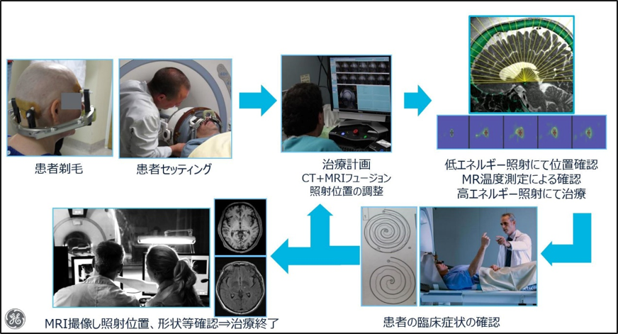 ExAblate4000_about_03