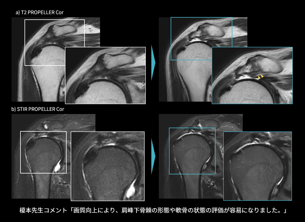 この患者さんリウマチ・膠原病かも？」と迷ったときの診断のカン