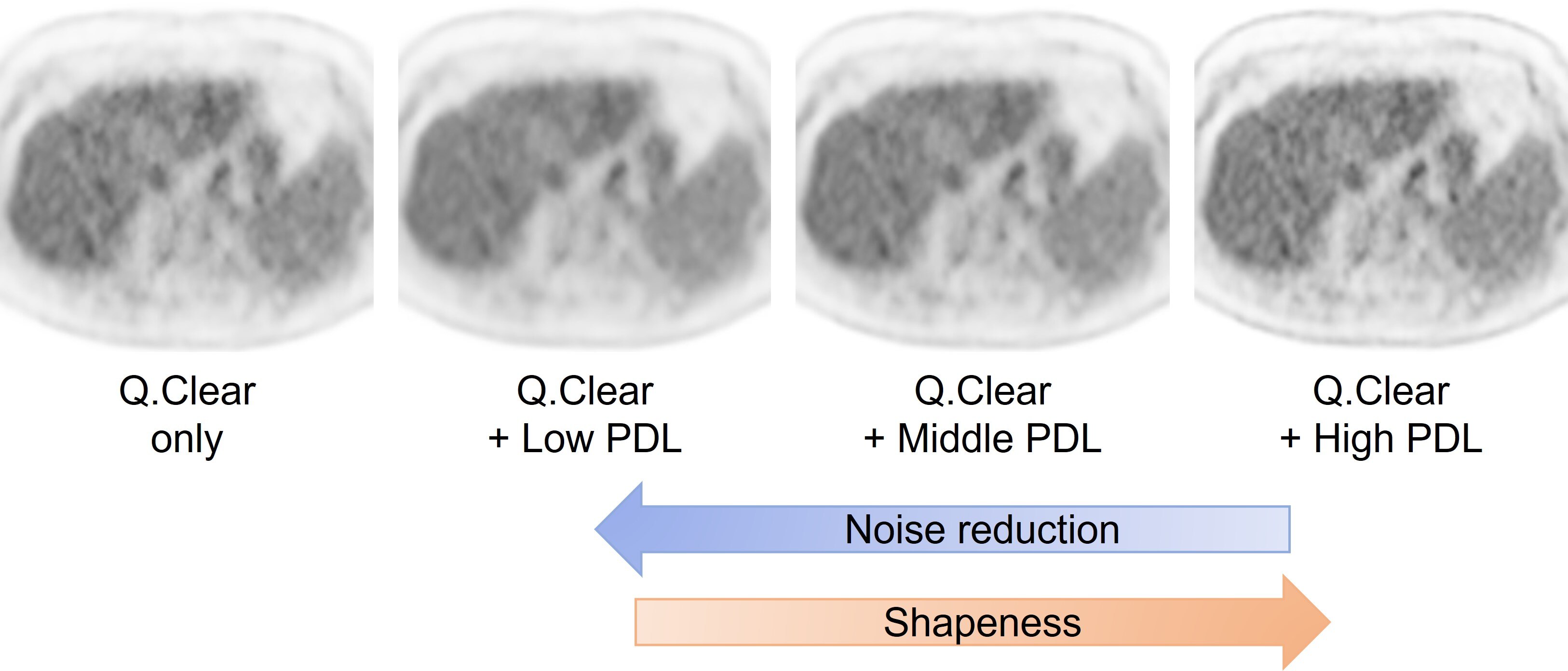 Omni Legend の使用経験とその臨床的な価値 | GE HealthCare (Japan)