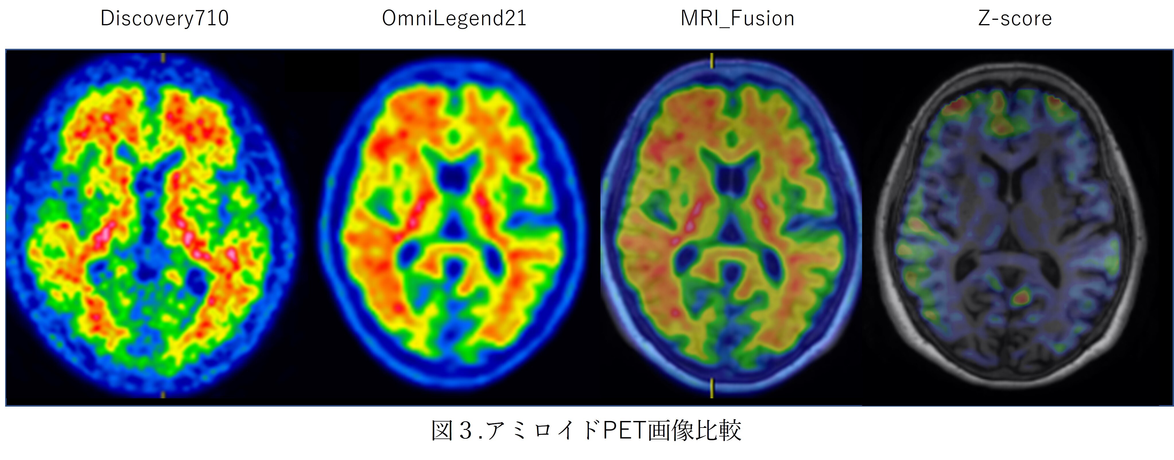 国内初号機 Omni Legend 21の使用経験 | GE HealthCare (Japan)