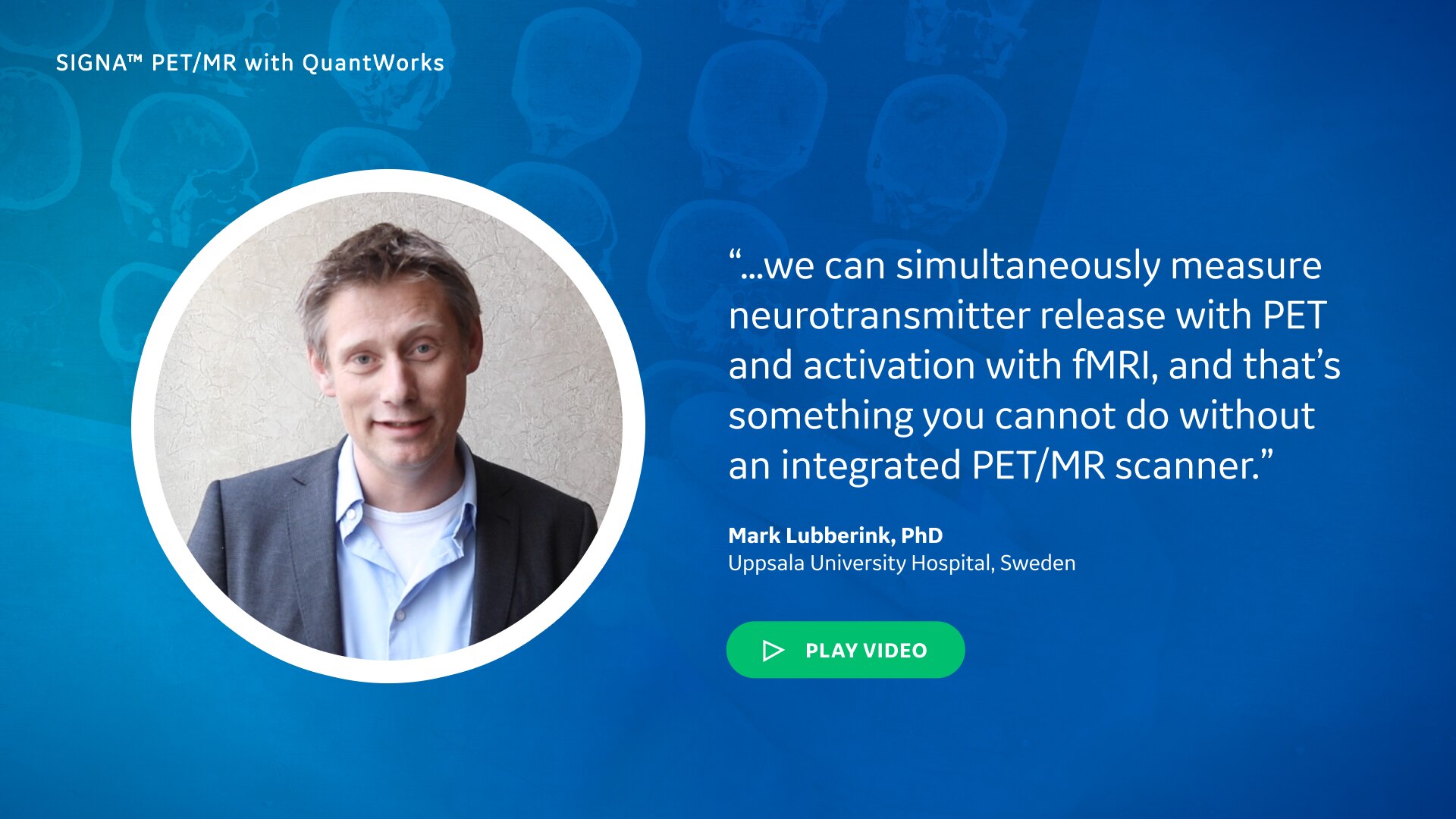 SIGNA™ PET/MR with QuantWorks | GE Healthcare (Japan)