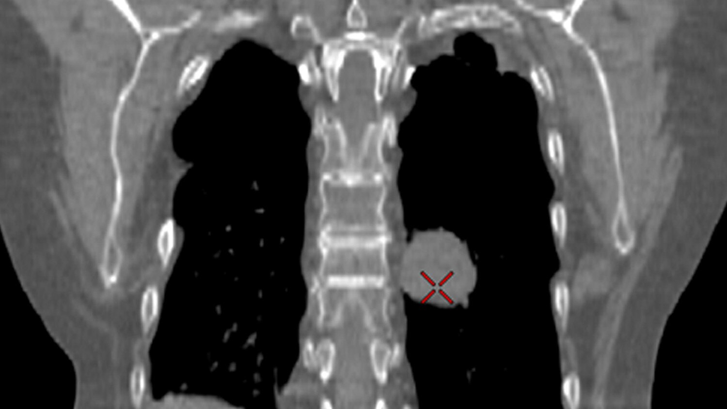 CT Advanced Visualization | GE HealthCare (Japan)